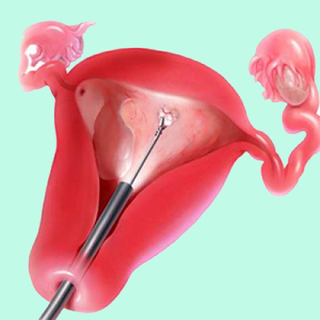 Reviva Treatments
