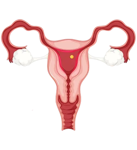 Ovulation Induction Treatment in Chandigarh