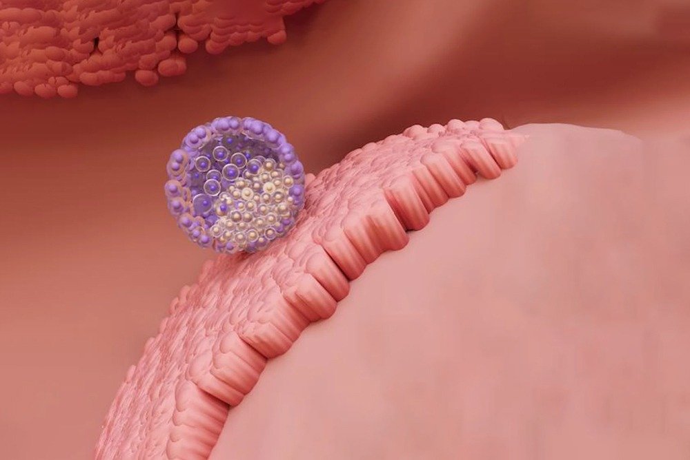 Embryo Implantation – Reviva IVF